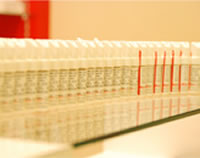 インプラント体（フィクスチャー）