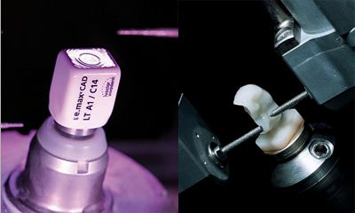 CEREC(セレック)システム