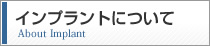 インプラントについて