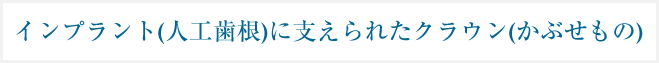 インプラント（人口歯根）に支えられたクラウン（かぶせもの）